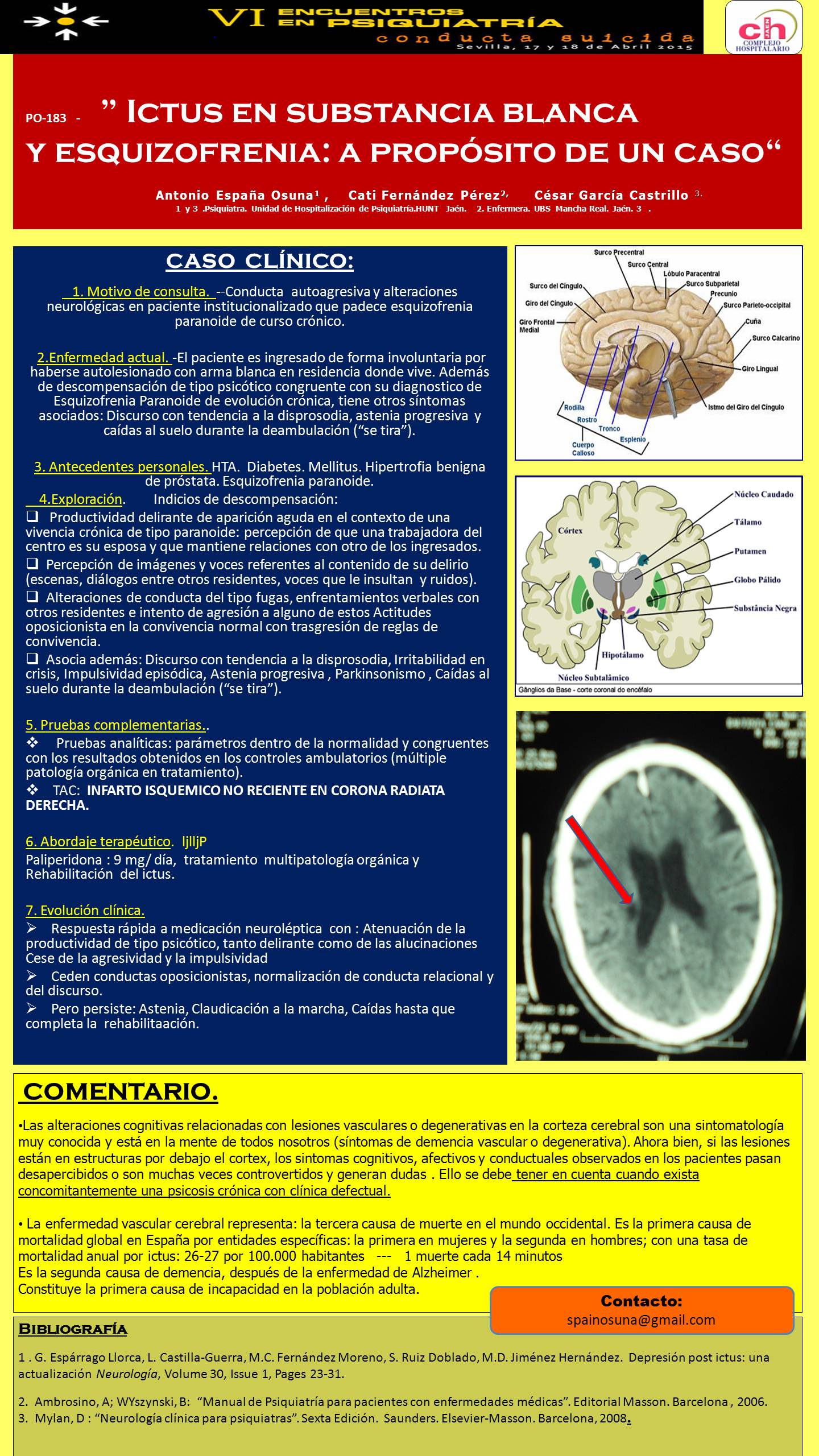 Importado desde XML